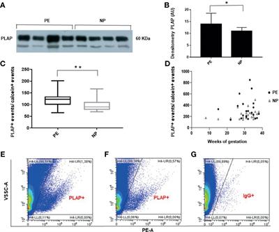 Circulating Placental Vesicles Carry HLA-DR in Pre-Eclampsia: A New Potential Marker of the Syndrome